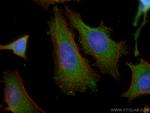 TSG101 Antibody in Immunocytochemistry (ICC/IF)