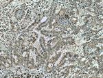 TSG101 Antibody in Immunohistochemistry (Paraffin) (IHC (P))