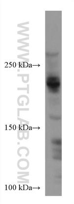 ARID4B Antibody in Western Blot (WB)