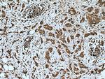 PTPN2 Antibody in Immunohistochemistry (Paraffin) (IHC (P))