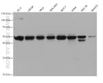 PTPN2 Antibody in Western Blot (WB)