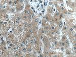 FGL1 Antibody in Immunohistochemistry (Paraffin) (IHC (P))