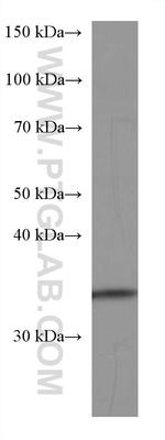 FGL1 Antibody in Western Blot (WB)