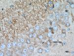 RGS14 Antibody in Immunohistochemistry (Paraffin) (IHC (P))