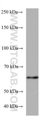 RGS14 Antibody in Western Blot (WB)