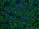 LACTB2 Antibody in Immunohistochemistry (Paraffin) (IHC (P))