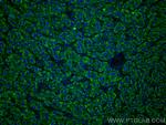 LACTB2 Antibody in Immunohistochemistry (Paraffin) (IHC (P))