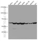 CCT5 Antibody in Western Blot (WB)