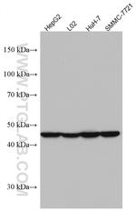 AGXT Antibody in Western Blot (WB)