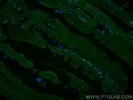 TRIM72 Antibody in Immunohistochemistry (PFA fixed) (IHC (PFA))