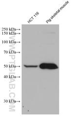 TRIM72 Antibody in Western Blot (WB)