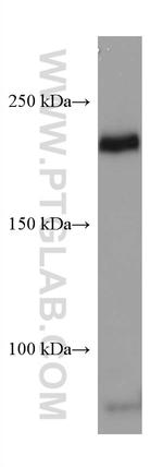 VEGFR2 Antibody in Western Blot (WB)