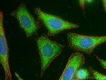 TYK2 Antibody in Immunocytochemistry (ICC/IF)