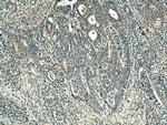 TYK2 Antibody in Immunohistochemistry (Paraffin) (IHC (P))