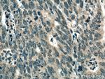 TYK2 Antibody in Immunohistochemistry (Paraffin) (IHC (P))