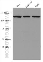 TYK2 Antibody in Western Blot (WB)