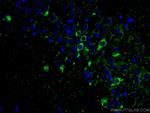 ACVR1 Antibody in Immunohistochemistry (Paraffin) (IHC (P))