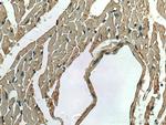 ACVR1 Antibody in Immunohistochemistry (Paraffin) (IHC (P))