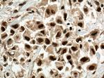 RBM39 Antibody in Immunohistochemistry (Paraffin) (IHC (P))