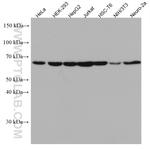 RBM39 Antibody in Western Blot (WB)