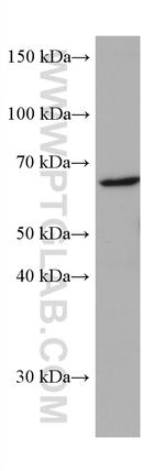 CYP21A2 Antibody in Western Blot (WB)