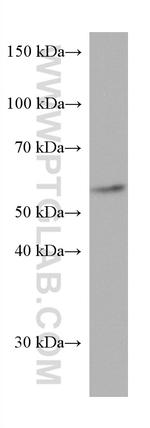 CYP21A2 Antibody in Western Blot (WB)