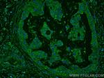 KLK11 Antibody in Immunohistochemistry (Paraffin) (IHC (P))