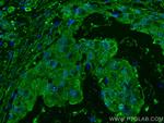 KLK11 Antibody in Immunohistochemistry (Paraffin) (IHC (P))