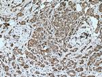 KLK11 Antibody in Immunohistochemistry (Paraffin) (IHC (P))