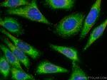 AMPD2 Antibody in Immunocytochemistry (ICC/IF)