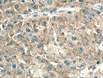 AMPD2 Antibody in Immunohistochemistry (Paraffin) (IHC (P))