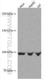 AMPD2 Antibody in Western Blot (WB)