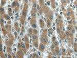 CYP20A1 Antibody in Immunohistochemistry (Paraffin) (IHC (P))