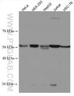 CYP20A1 Antibody in Western Blot (WB)