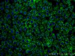 BDH1 Antibody in Immunohistochemistry (Paraffin) (IHC (P))