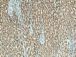 BDH1 Antibody in Immunohistochemistry (Paraffin) (IHC (P))