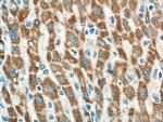 BDH1 Antibody in Immunohistochemistry (Paraffin) (IHC (P))