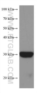 BDH1 Antibody in Western Blot (WB)