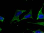 ALDOA Antibody in Immunocytochemistry (ICC/IF)