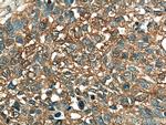 ALDOA Antibody in Immunohistochemistry (Paraffin) (IHC (P))