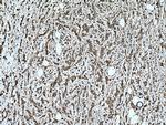 HMBS Antibody in Immunohistochemistry (Paraffin) (IHC (P))