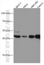 HMBS Antibody in Western Blot (WB)