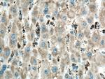 ME2 Antibody in Immunohistochemistry (Paraffin) (IHC (P))