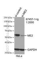 ME2 Antibody in Western Blot (WB)