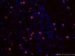 PTBP1 Antibody in Immunohistochemistry (Paraffin) (IHC (P))