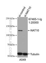 NAT10 Antibody in Western Blot (WB)