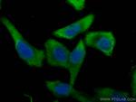 PGAM1 Antibody in Immunocytochemistry (ICC/IF)