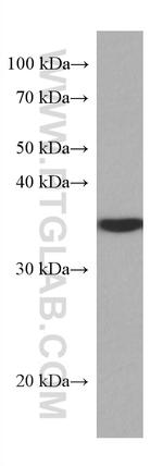 SET Antibody in Western Blot (WB)