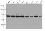 PIP5K1A Antibody in Western Blot (WB)