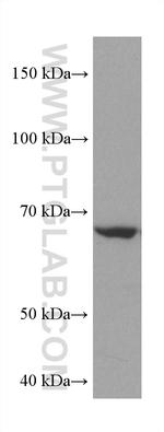 AHCYL2 Antibody in Western Blot (WB)